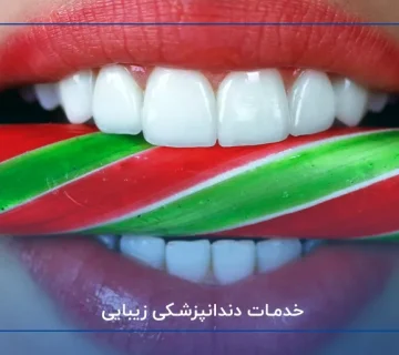 خدمات دندانپزشکی زیبایی