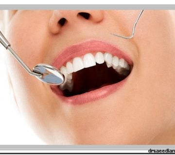 جرم‌گیری دندان در کلینیک دندانپزشکی دکتر سعیدیان