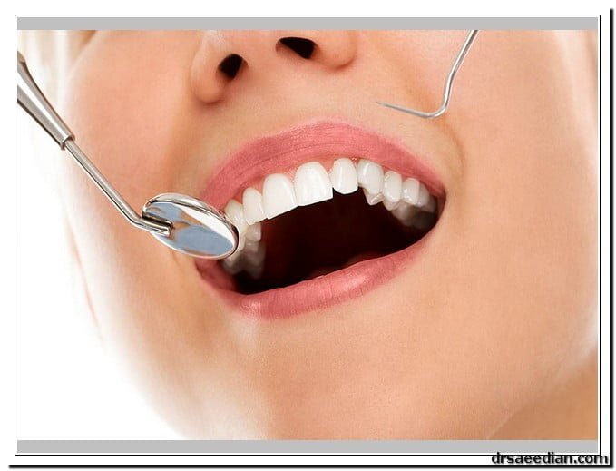 جرم‌گیری دندان در کلینیک دندانپزشکی دکتر سعیدیان