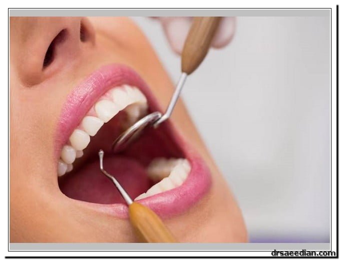 اهمیت جرم‌گیری دندان و تاثیر آن بر سلامت دهان