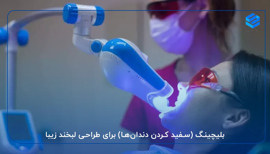 بلیچینگ (سفید کردن دندان‌ها) برای طراحی لبخند زیبا