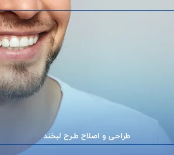 طراحی و اصلاح طرح لبخند