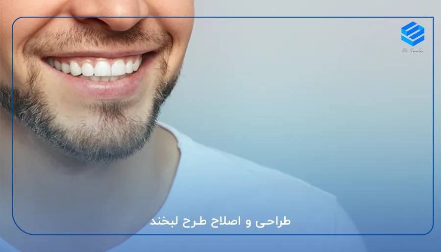 طراحی و اصلاح طرح لبخند