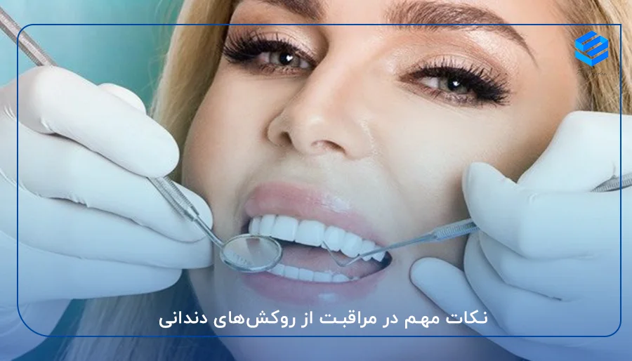 نکات مهم در مراقبت از روکش‌های دندانی :