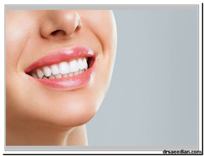 پروتز دندان