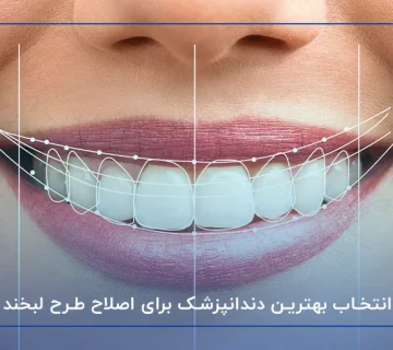 انتخاب بهترین دندانپزشک برای اصلاح طرح لبخند در نیاوران