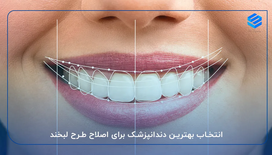 انتخاب بهترین دندانپزشک برای اصلاح طرح لبخند در نیاوران
