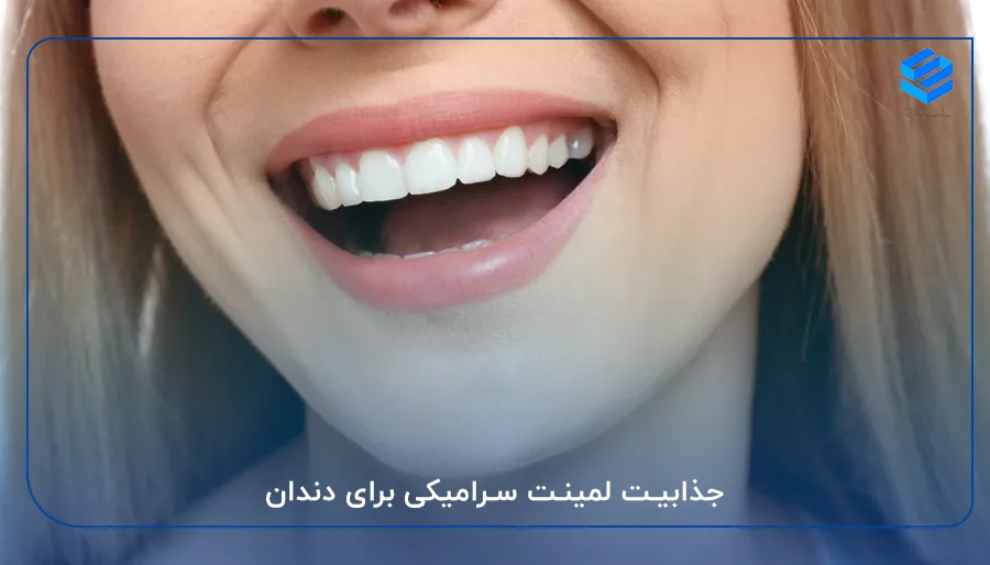 جذابیت لمینت سرامیکی برای دندان