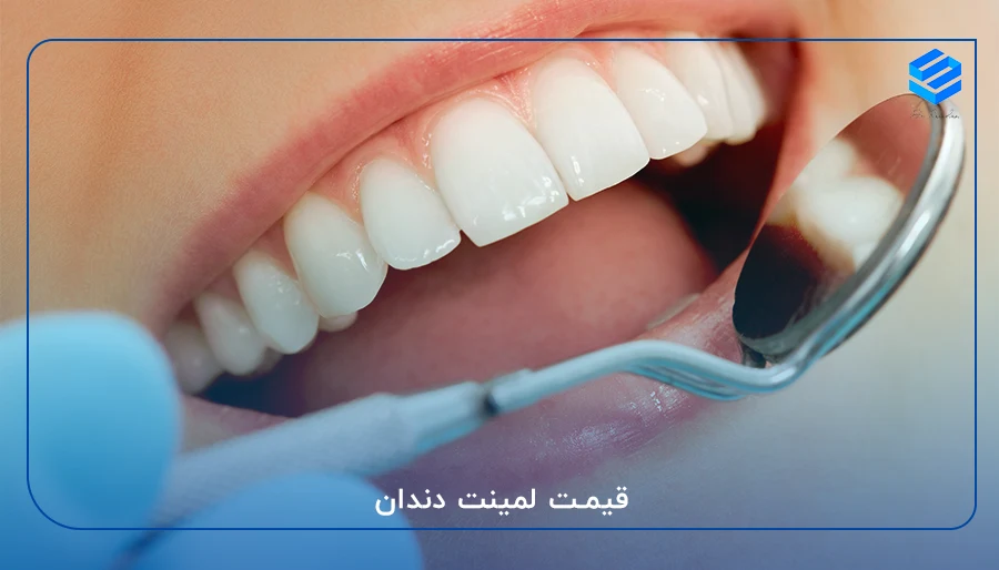 قیمت لمینت دندان در سال 1403