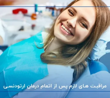 مراقبت‌ های لازم پس از اتمام درمان ارتودنسی