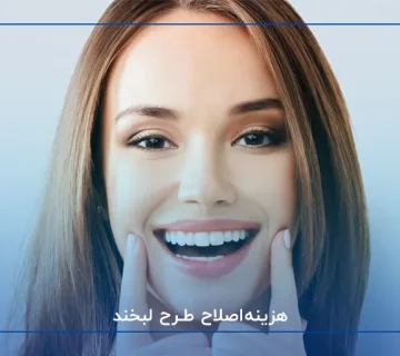 هزینه‌اصلاح طرح لبخند