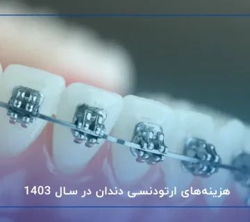 هزینه‌های ارتودنسی دندان در سال 1403