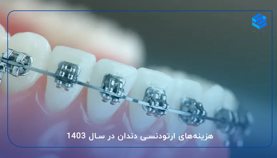 هزینه‌های ارتودنسی دندان در سال 1403