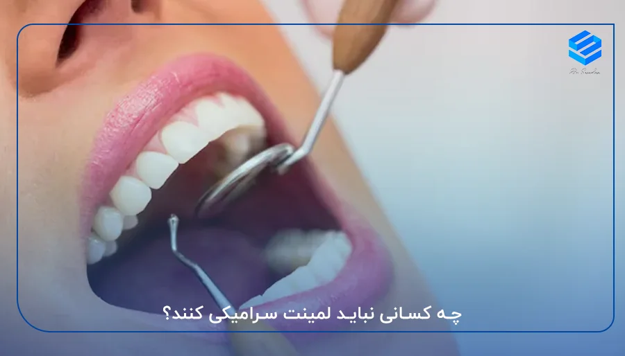 چه کسانی نباید لمینت سرامیکی کنند؟