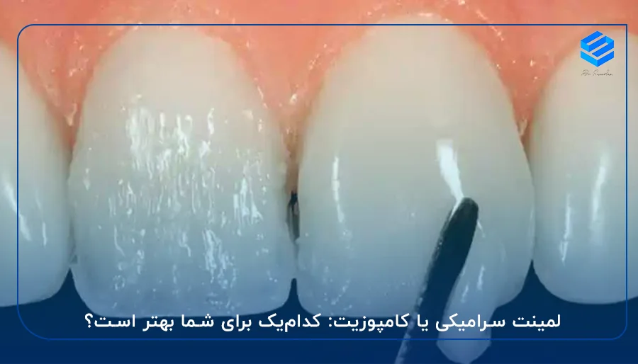 کدام‌یک برای شما بهتر است؟