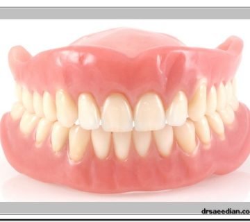 پروتز دندان در کلینیک دندانپزشکی دکتر وحید سعیدیان