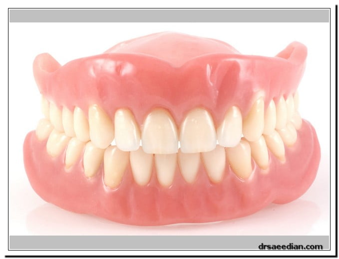 پروتز دندان در کلینیک دندانپزشکی دکتر وحید سعیدیان