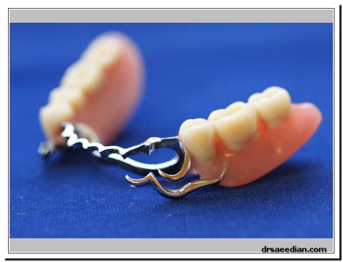 قیمت پروتز دندان