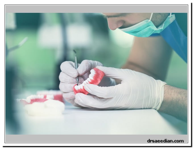 انواع پروتز دندان