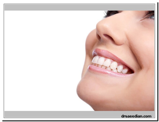 روش‌های بلیچینگ دندان