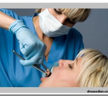 جراحی دندان عقل در کلینیک دندانپزشکی دکتر وحید سعیدیان