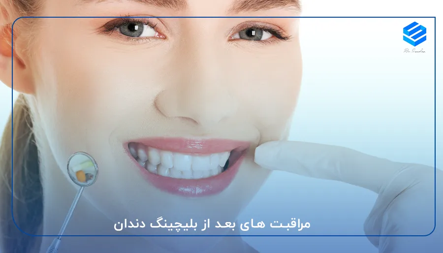 حفظ زیبایی لبخند با مراقبت های بعد از بلیچینگ دندان