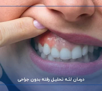 درمان لثه تحلیل رفته بدون جراحی