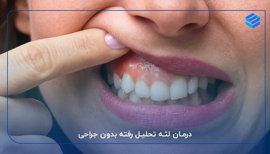 درمان لثه تحلیل رفته بدون جراحی