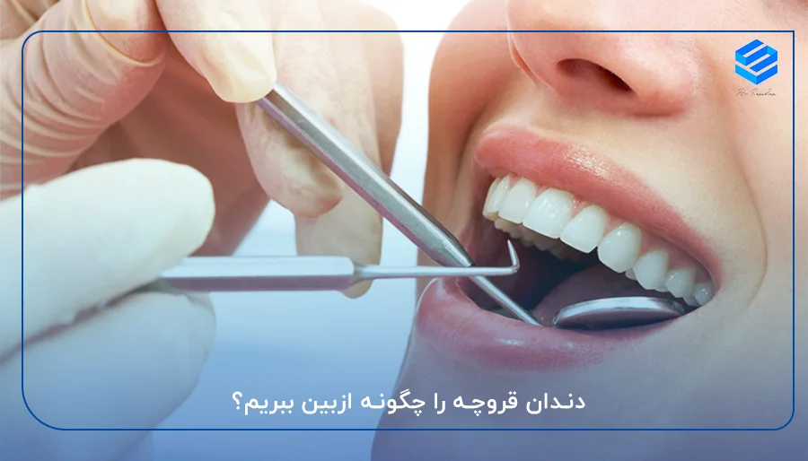 دندان قروچه را چگونه ازبین ببریم؟