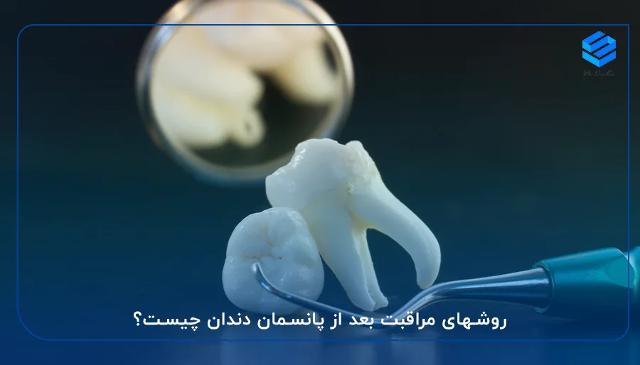 روشهای مراقبت‌ بعد از پانسمان دندان چیست؟