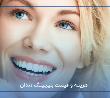 هزینه و قیمت بلیچینگ دندان