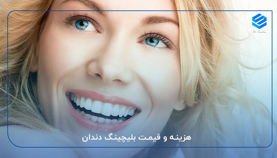 هزینه و قیمت بلیچینگ دندان