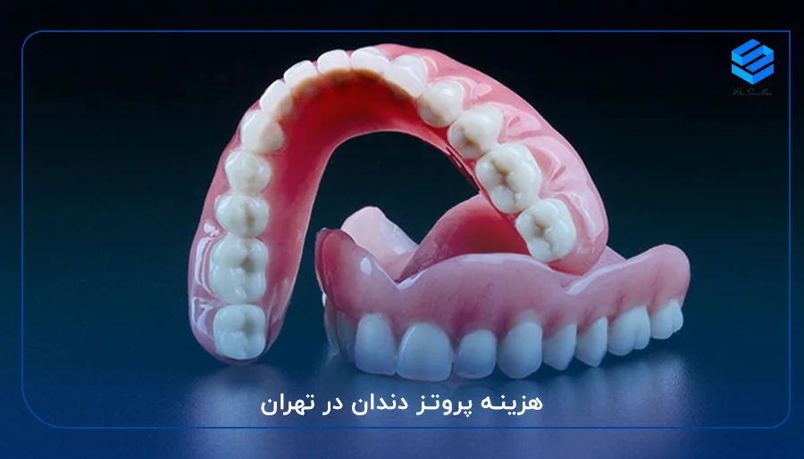 هزینه پروتز دندان در تهران
