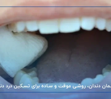 پانسمان دندان، روشی موقت و ساده برای تسکین درد دندان