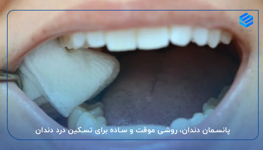 پانسمان دندان، روشی موقت و ساده برای تسکین درد دندان