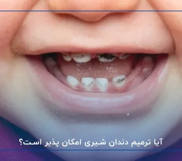 آیا ترمیم دندان شیری امکان پذیر است؟