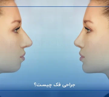 جراحی فک چیست؟