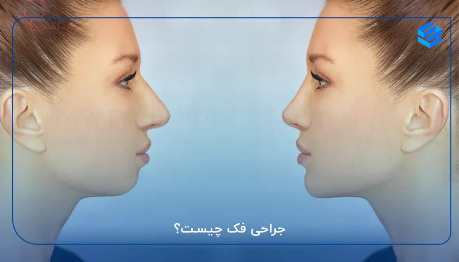 جراحی فک چیست؟