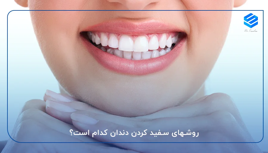 روشهای سفید کردن دندان کدام است؟