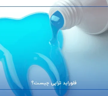 فلوراید تراپی چیست؟