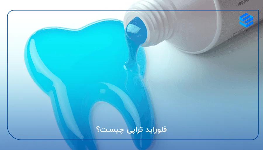 فلوراید تراپی چیست؟