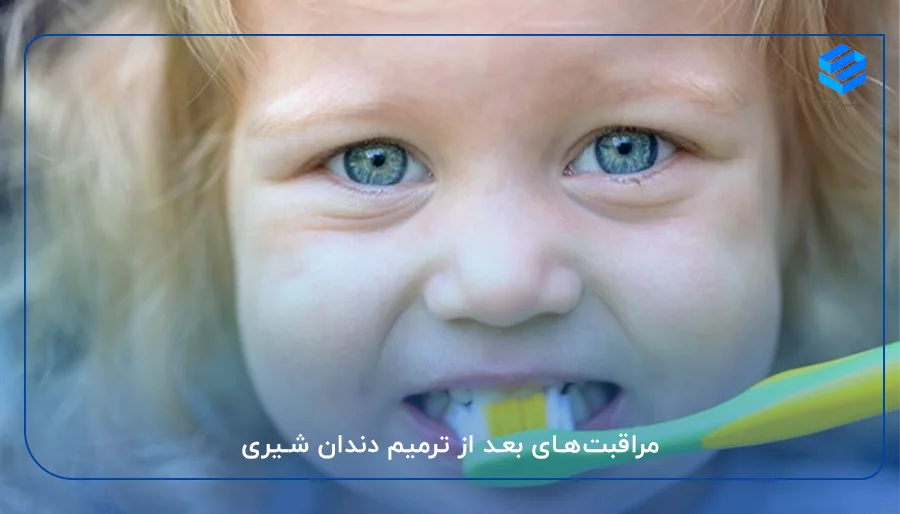 مراقبت‌های بعد از ترمیم دندان شیری