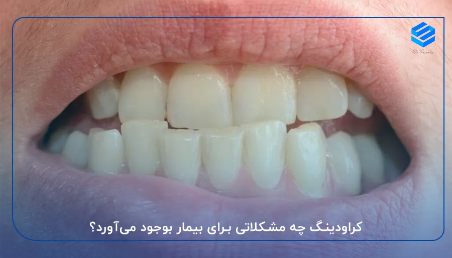 کراودینگ چه مشکلاتی برای بیمار بوجود می‌آورد؟