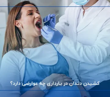 کشیدن دندان در بارداری چه عوارضی دارد؟