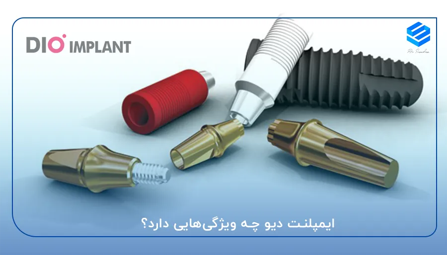 ایمپلنت دیو چه ویژگی‌هایی دارد؟