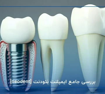 بررسی جامع ایمپلنت نئودنت [neodent]