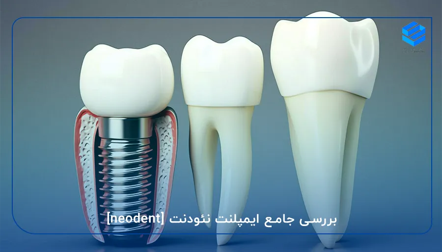 بررسی جامع ایمپلنت نئودنت [neodent]