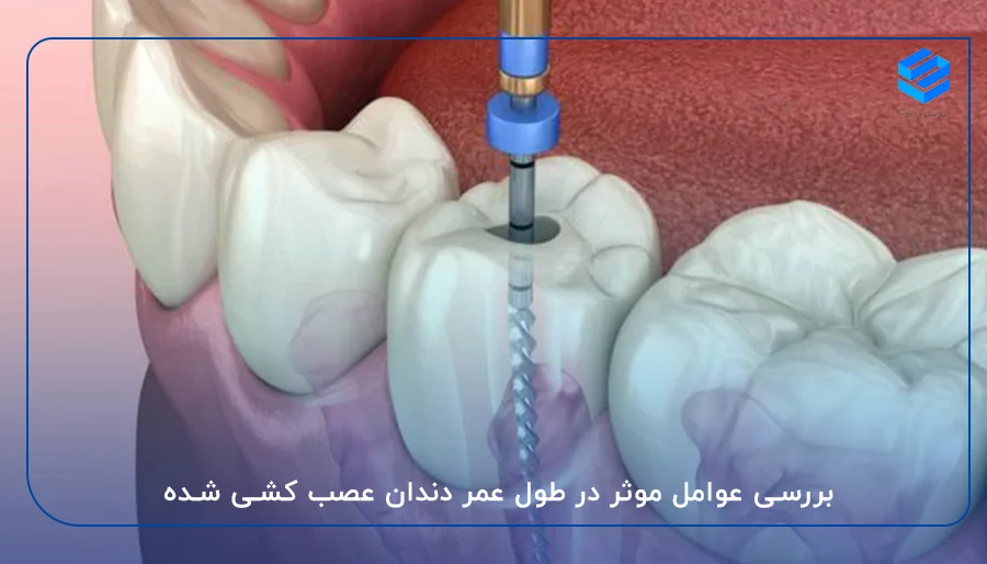 بررسی عوامل موثر در طول عمر دندان عصب کشی شده