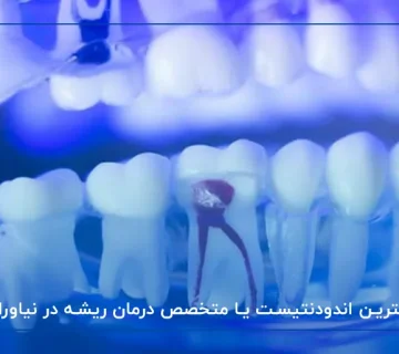 بهترین اندودنتیست یا متخصص درمان ریشه در نیاوران