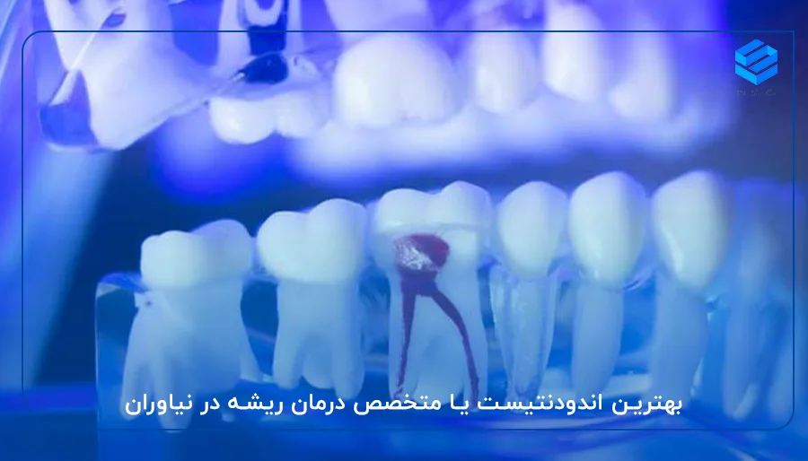 بهترین اندودنتیست یا متخصص درمان ریشه در نیاوران
